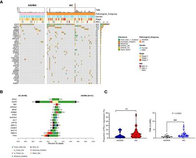 Genomic landscape and tumor mutational features of resected preinvasive to invasive lung adenocarcinoma